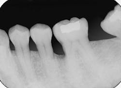 Th Rdh117965 56 Th Rdh117965 56