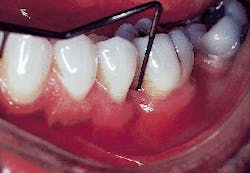 Th Rdh117965 57 Th Rdh117965 57