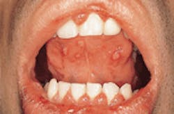 Th Rdh118022 5 Th Rdh118022 5