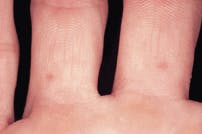 Th Rdh118049 40 Th Rdh118049 40