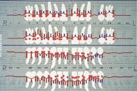 Th Rdh118122 76 Th Rdh118122 76