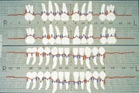 Th Rdh118122 77 Th Rdh118122 77