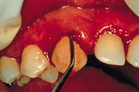 Th Rdh118122 78 Th Rdh118122 78