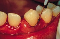 Th Rdh118122 79 Th Rdh118122 79