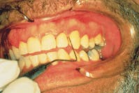 Th Rdh118122 80 Th Rdh118122 80