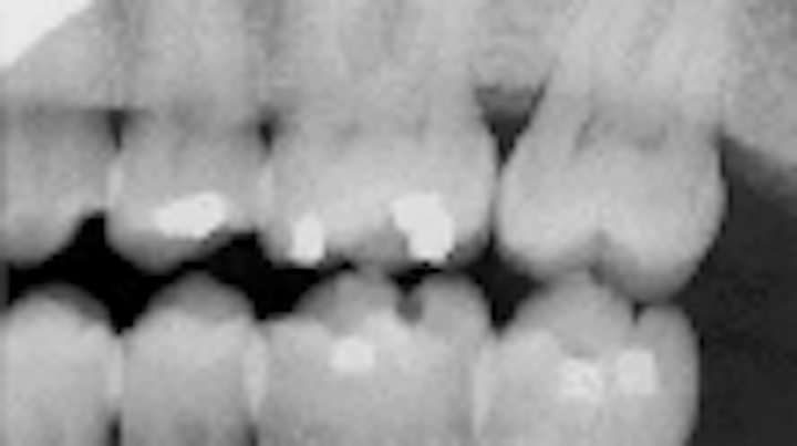 Th Rdh122644 54
