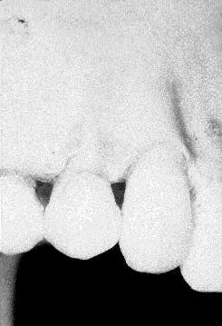 Th Rdh122788 51 Th Rdh122788 51