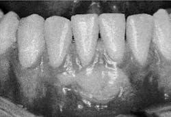 Th Rdh122788 52 Th Rdh122788 52