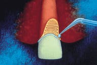 Th Rdh122813 56 Th Rdh122813 56