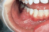 Th Rdh122893 30 Th Rdh122893 30