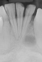 Th Rdh122939 161 Th Rdh122939 161