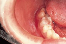 Th Rdh122939 187 Th Rdh122939 187