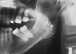 Th Rdh122939 213 Th Rdh122939 213