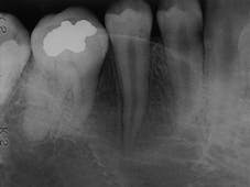 Th Rdh122939 239 Th Rdh122939 239