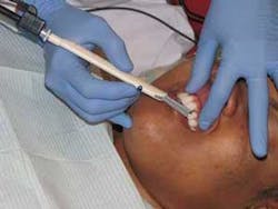 Th Roi On Probing 01 Th Roi On Probing 01