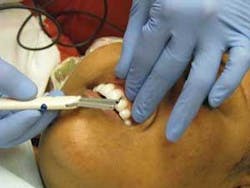 Th Roi On Probing 02 Th Roi On Probing 02