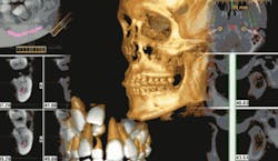 Th The Cone Beam 01 Th The Cone Beam 01