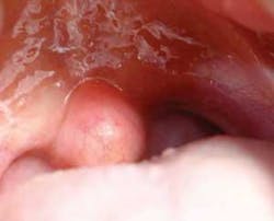 Th The Uvula 03 Th The Uvula 03