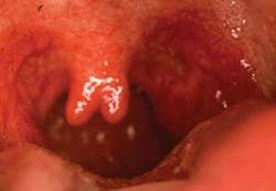 Th The Uvula 04 Th The Uvula 04