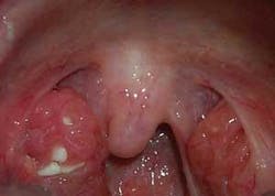 Th The Uvula 05 Th The Uvula 05