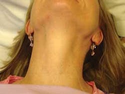 Th Thyro 1009 03 Th Thyro 1009 03