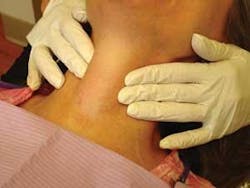 Th Thyro 1009 04 Th Thyro 1009 04