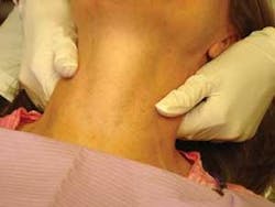 Th Thyro 1009 05 Th Thyro 1009 05