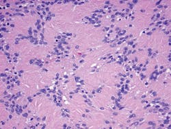 1601rdhcbur P02 1601rdhcbur P02