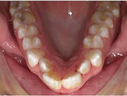 1601rdhfpgp P01 1601rdhfpgp P01