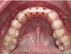 1601rdhfpgp P03 1601rdhfpgp P03