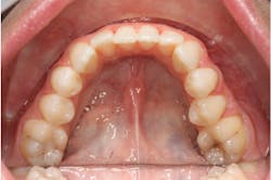 1601rdhfpgp P04 1601rdhfpgp P04