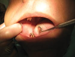 1602rdhfflb P03a 1602rdhfflb P03a