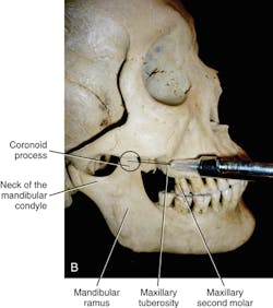 1602rdhfflb P04b 1602rdhfflb P04b
