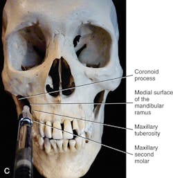 1602rdhfflb P04c 1602rdhfflb P04c