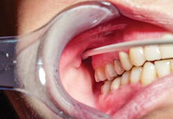 1602rdhfflb P05 1602rdhfflb P05