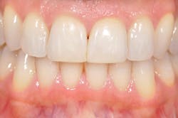 1602rdhfvig P02 1602rdhfvig P02