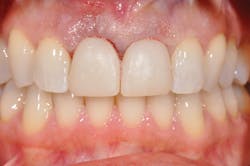 1602rdhfvig P06 1602rdhfvig P06