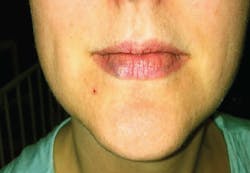 1603rdh 601 1603rdh 601