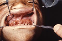 1303rdhcbur 1303rdhcbur