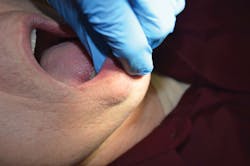 1604rdhfhoc P02 1604rdhfhoc P02