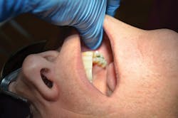 1604rdhfhoc P03 1604rdhfhoc P03