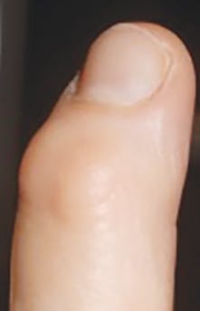 1605rdhcbur P01 1605rdhcbur P01