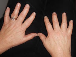 1605rdhcbur P02 1605rdhcbur P02