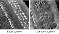 Intact cochlea: The photo showing multiple chevron-shaped rows of outer hair cells and a single row of inner hair cells in a healthy cochlea. Damaged cochlea: Extensive loss of outer hair cells and significant damage to the row of inner hair cells. Photo courtesy of House Ear Institute. Intact cochlea: The photo showing multiple chevron-shaped rows of outer hair cells and a single row of inner hair cells in a healthy cochlea. Damaged cochlea: Extensive loss of outer hair cells and significant damage to the row of inner hair cells. Photo courtesy of House Ear Institute.