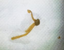 Biofilm From Bottle Waterline Biofilm From Bottle Waterline