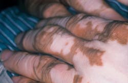 1609rdhcbur P01 1609rdhcbur P01