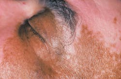 1609rdhcbur P02 1609rdhcbur P02