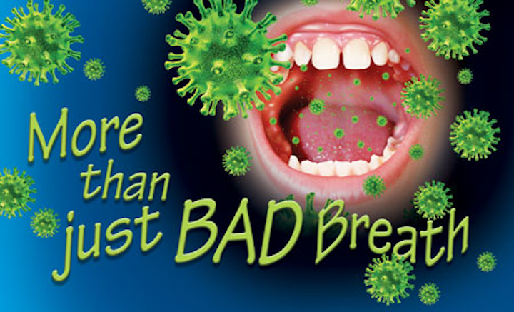 More than just bad Breath: Halitosis should be treated due to its impact on  overall health | Registered Dental Hygienist (RDH) Magazine