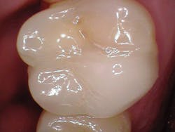 1610rdhficl P02 1610rdhficl P02