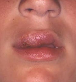 1611rdhcbur P01a 1611rdhcbur P01a